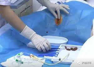 可立尿视频,神奇产品背后的科学原理与实际应用