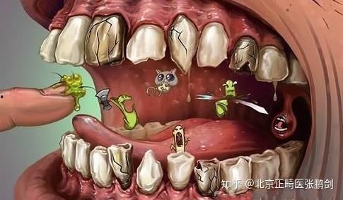 拔立事牙视频,揭秘牙齿矫正过程中的关键一步