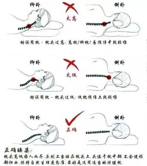 颈椎牵引正确姿势视频